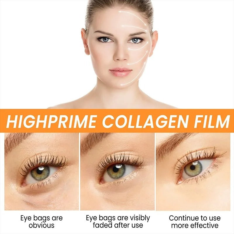 Korea Collagen Eye Patches – 10pcs Anti-Aging, Dark Circle & Puffiness Remover